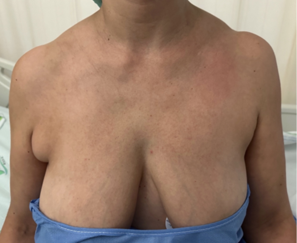 fig-1-mama