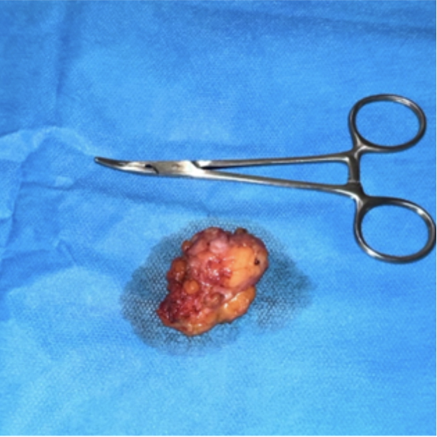 fig-2-mama